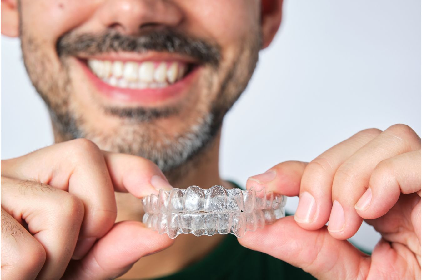 clear aligners