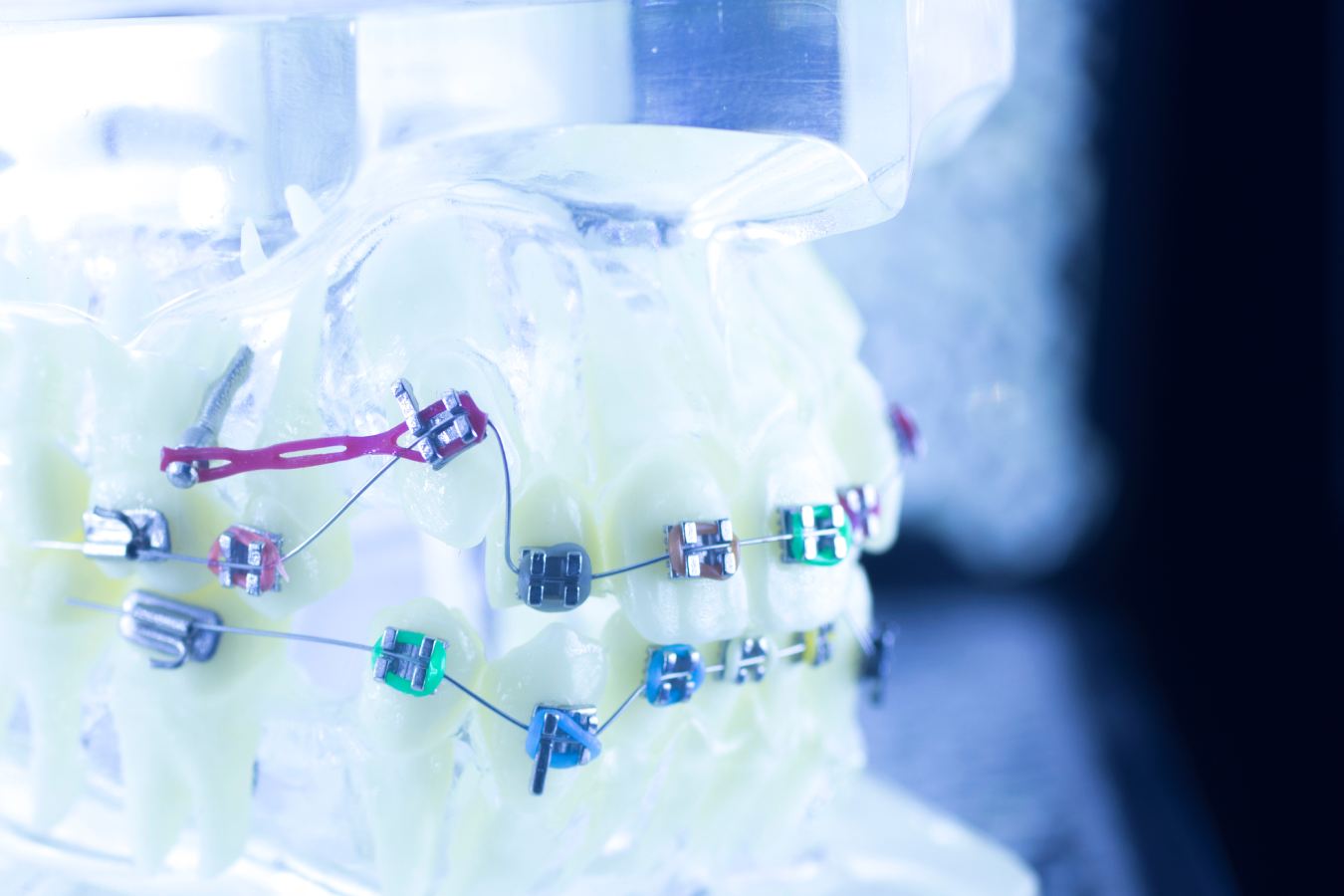 Braces cost and financing questions at Gamblin Orthodontics