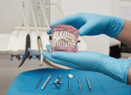 Dentist showing braces